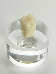 オールセラミッククラウン