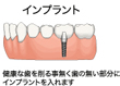 インプラント治療