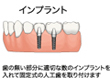 インプラント治療