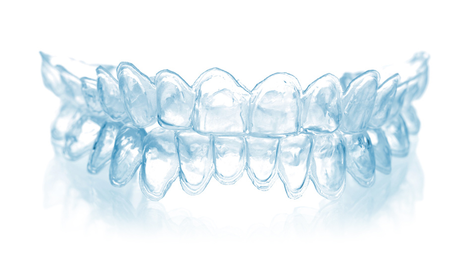 マウスピース矯正